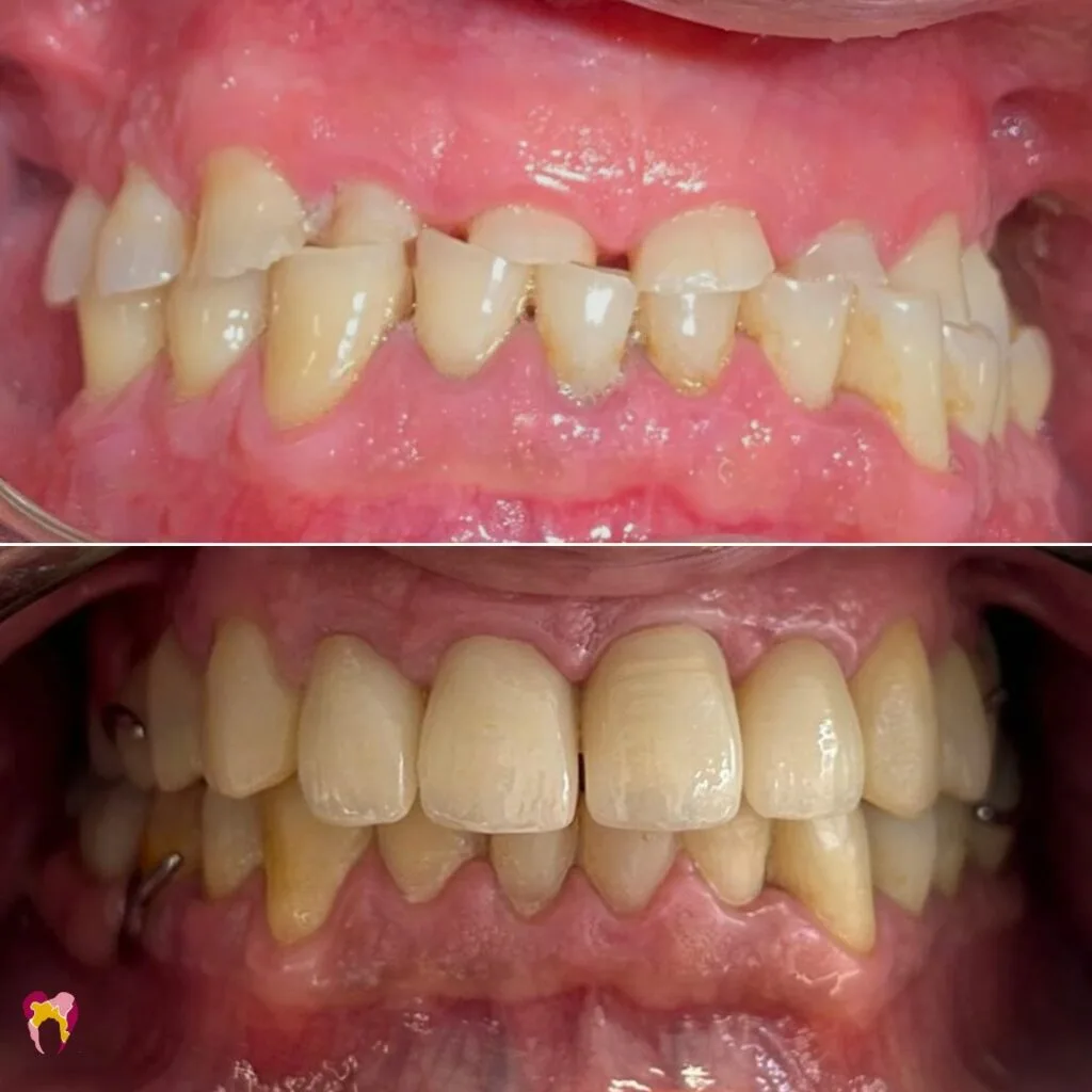CASO CLINICO REHAB COMPLETA